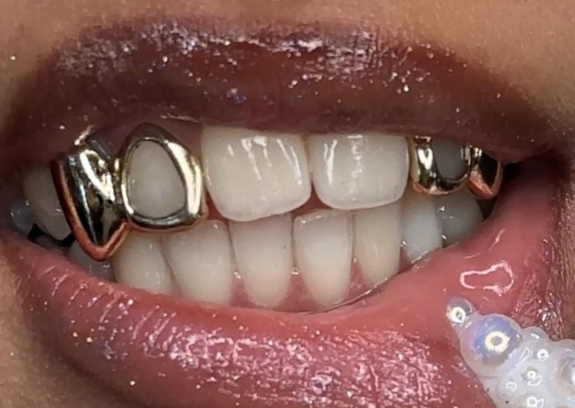 Fangs and Windows Gold Grillz