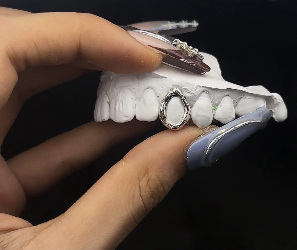 Melted Gold Window Grillz