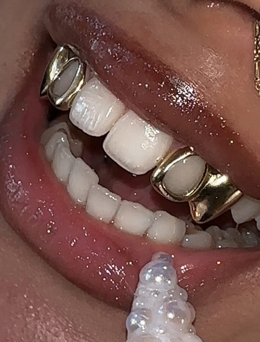Fangs and Windows Gold Grillz
