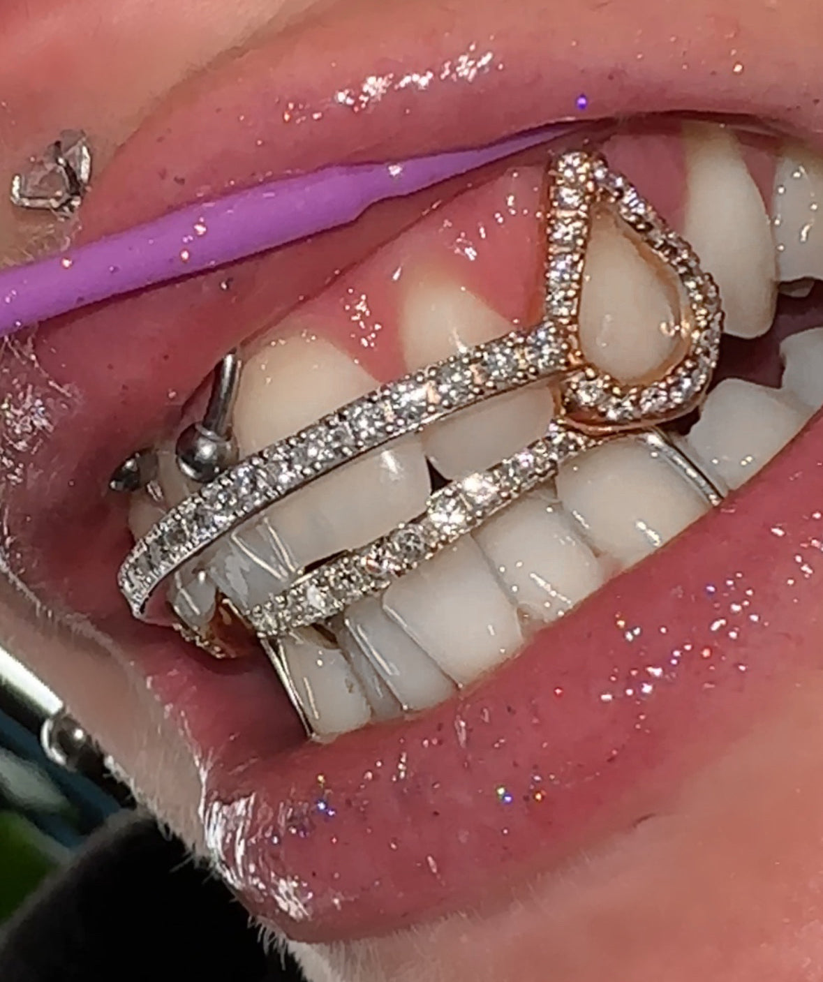 Gold Icy Bar Bottom Diamond Grillz