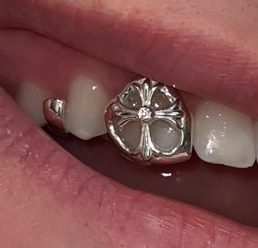 Diamond Chrome Gold Grillz