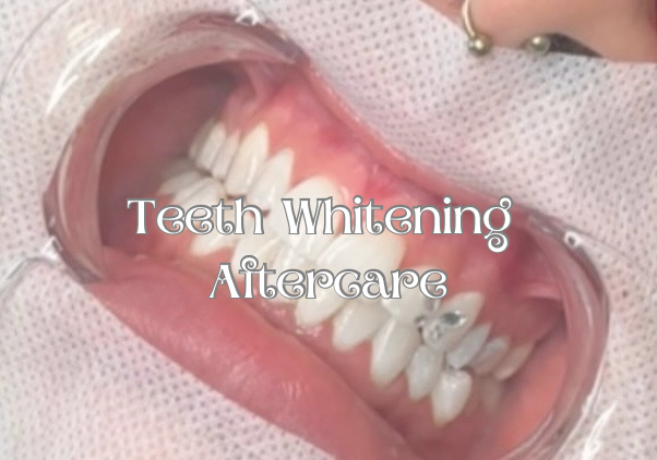 Teeth Whitening Aftercare