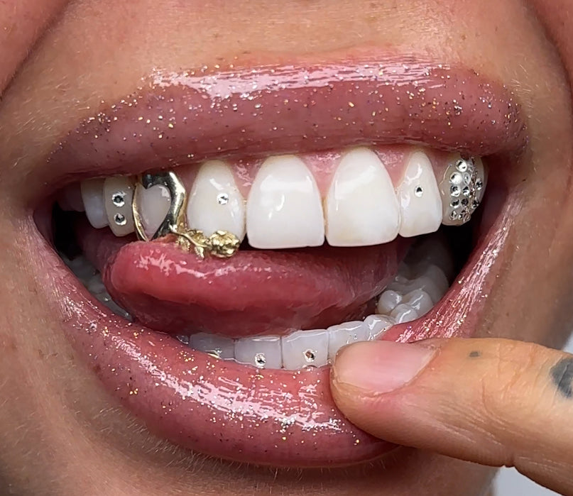 10ct Gold Grillz