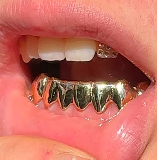 10ct Gold 8 Bottom Grillz