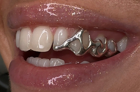 10ct Gold Grillz