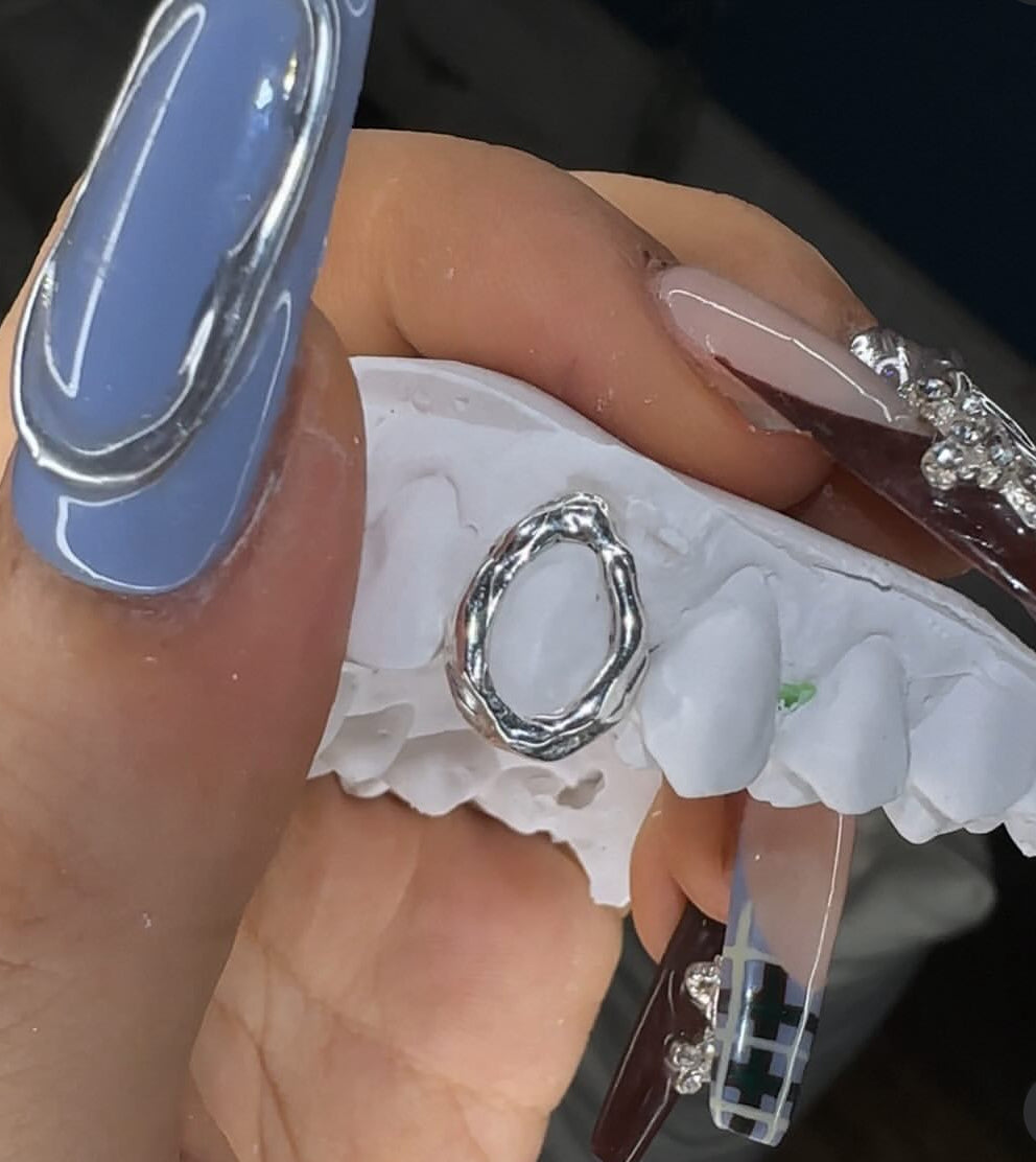 Melted Gold Window Grillz