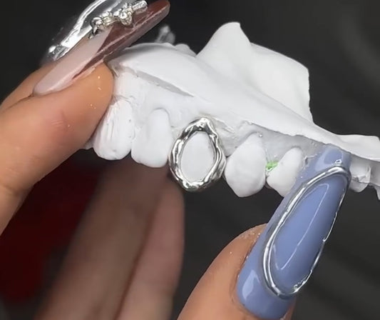 Melted Gold Window Grillz