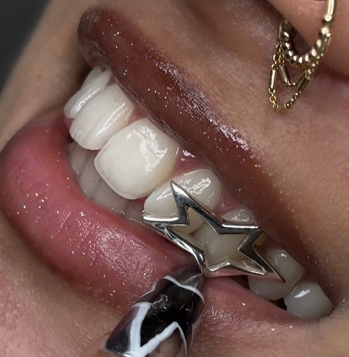 Gold Star Grillz