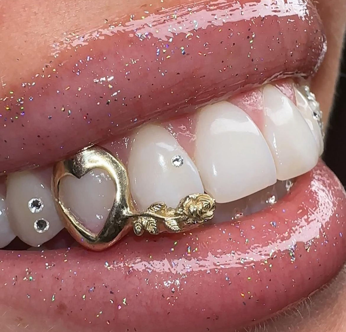 Dental store grillz