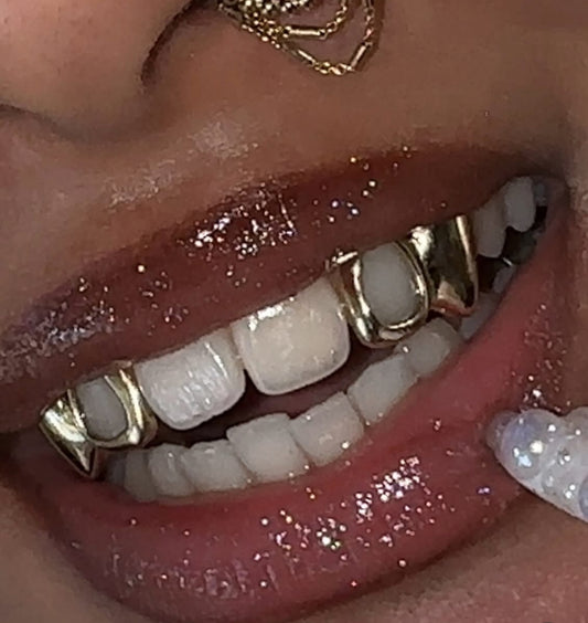 Fangs and Windows Gold Grillz
