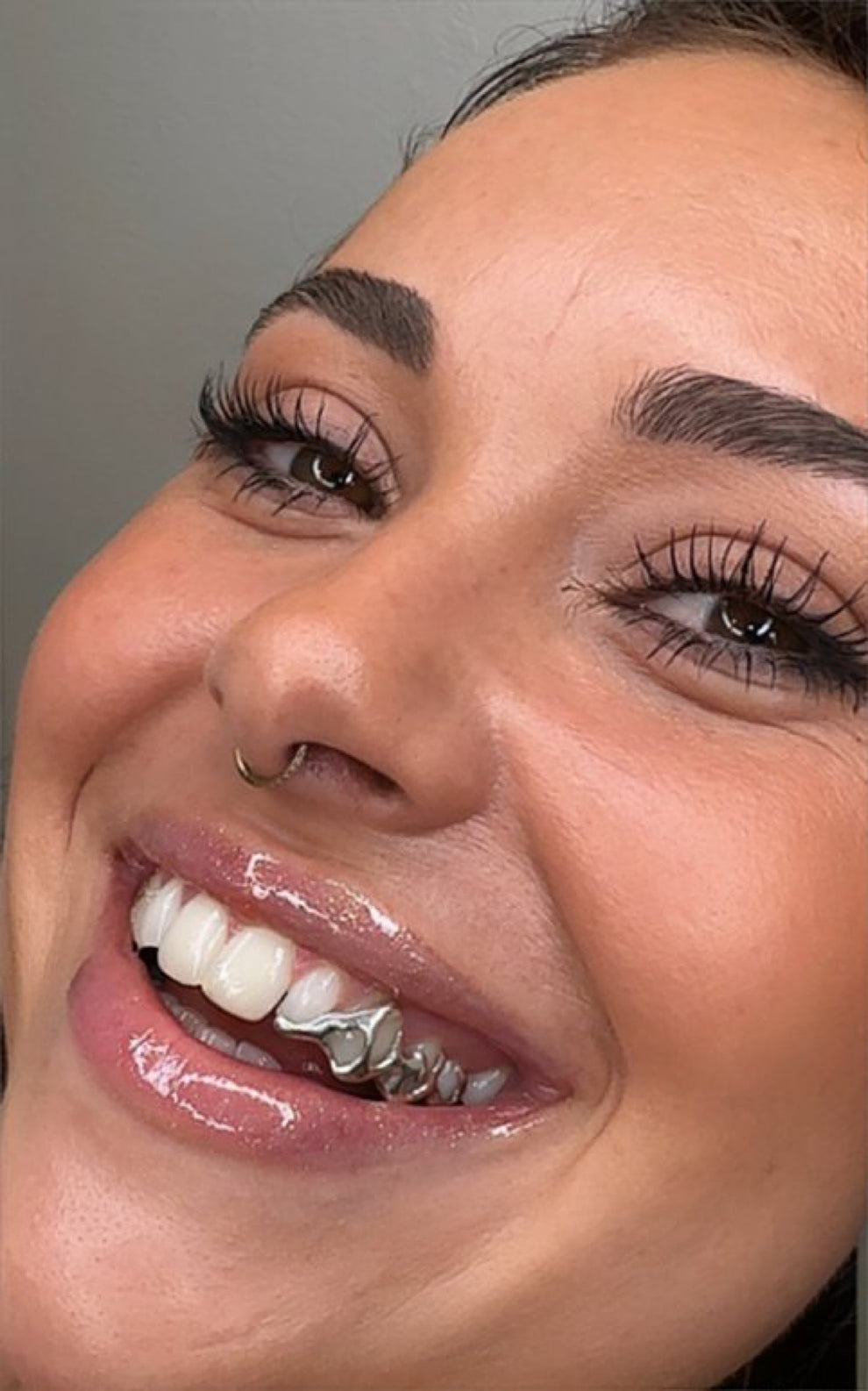 12 Piece Solid Top & Bottom Grillz | Grillz Melbourne Australia